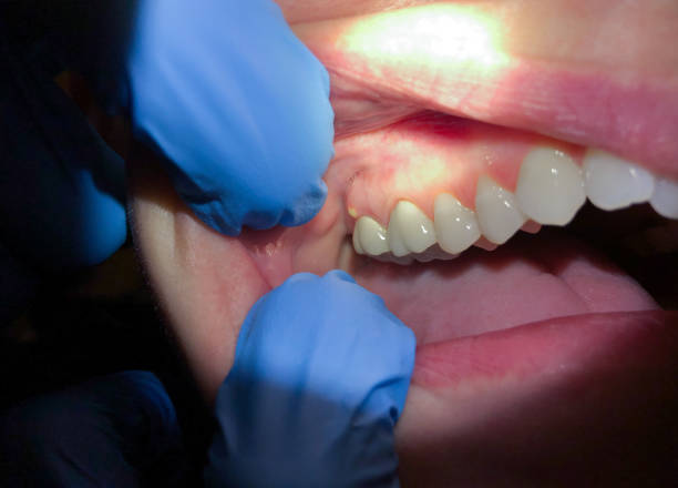 Best Emergency Dental Surgery in Sho Creek, AL