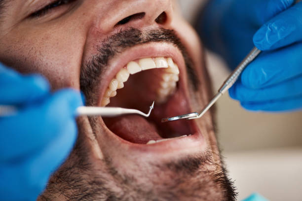Best Emergency Treatment for Toothache in Sho Creek, AL